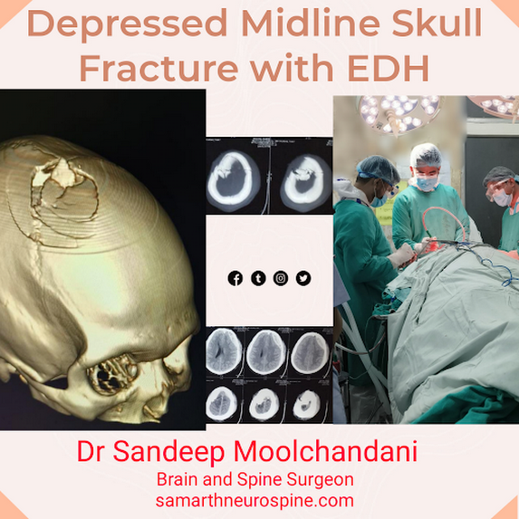 Best Neurosurgeon/ Neurologist in Indore