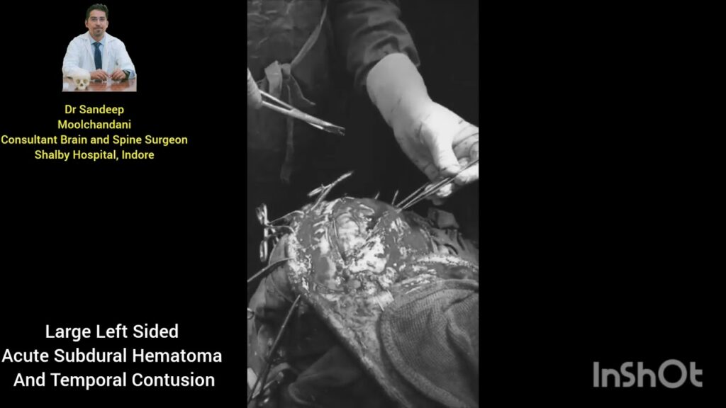 Head Injury Treatment in Indore