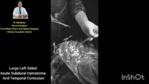 Head Injury Treatment in Indore