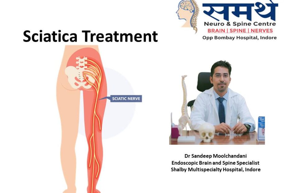 Sciatica Treatment in Indore