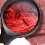 Nerve symptoms like numbness and weakness with neurologist in Indore (न्यूरोलॉजिस्ट इन इंदौर) consultation