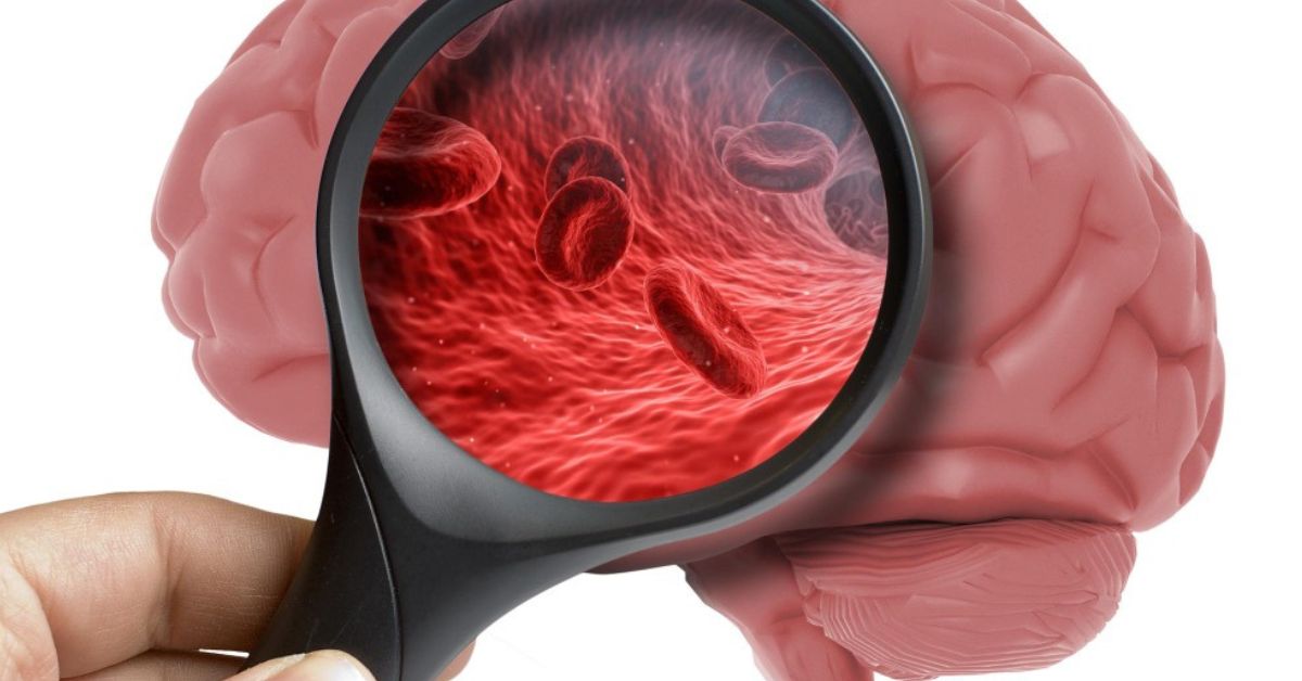 क्या नसों के लक्षण हमेशा ब्रेन से जुड़े होते हैं?