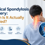 Cervical Spondylosis Surgery: When Is It Actually Needed?