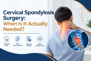 Cervical Spondylosis Surgery: When Is It Actually Needed?